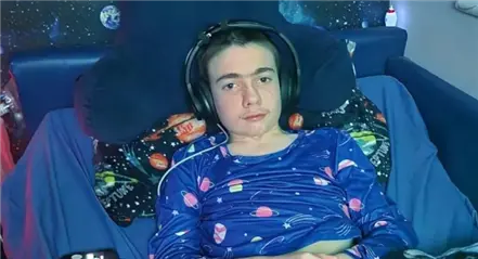 英国男孩颅内植入设备控制癫痫发作